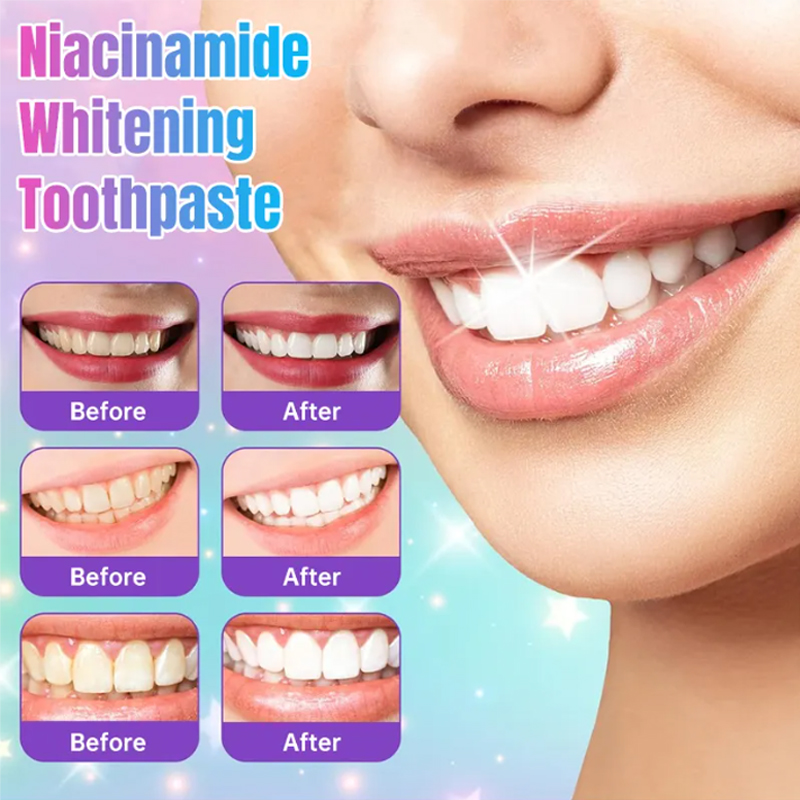 Niacinamide Toothpaste,Niacinamide Intensive Toothpaste,Fresh Breath Toothpastes, Remove Tooth Stains (3.8oz)