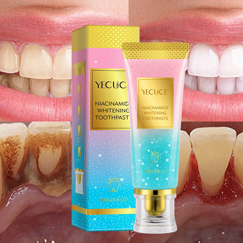 Niacinamide Toothpaste,Niacinamide Intensive Toothpaste,Fresh Breath Toothpastes, Remove Tooth Stains (3.8oz)