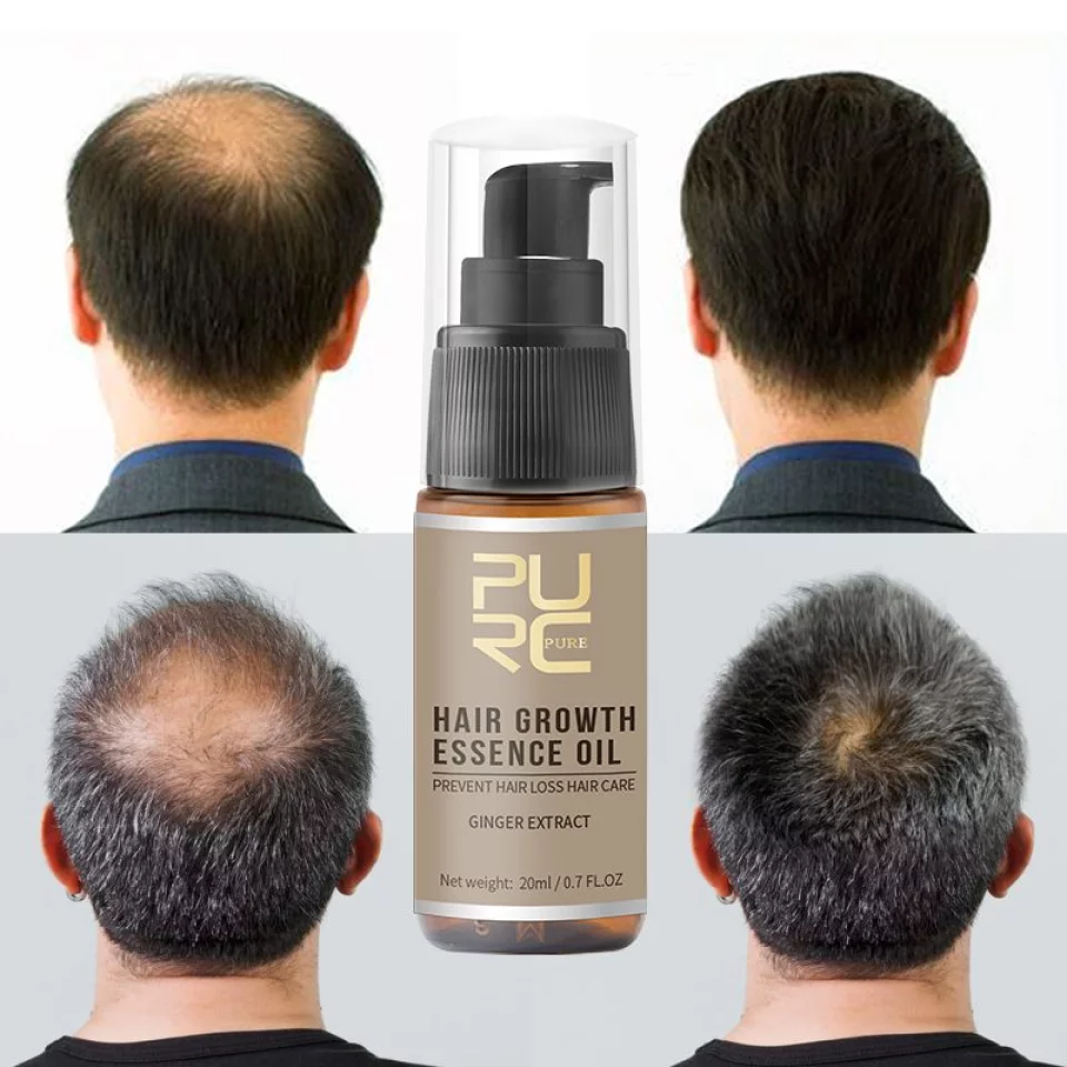 PURC Anti Hair Loss Spray Essence 20ml - Beard Growth Stimulator, Natural Hair and Facial Hair Grower Oil